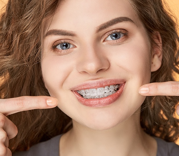 Woman pointing to smile with conventional braces