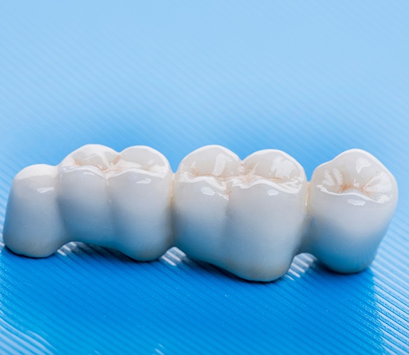 A closeup of a dental bridge against a blue background