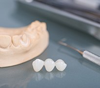 A closeup of a traditional dental bridge next to dental tools