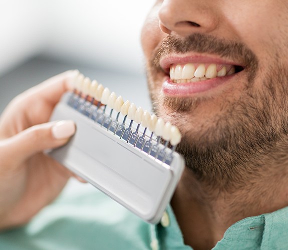 Man's smile compared with porcelain veneers color chart