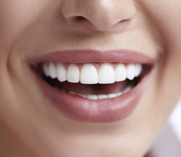 Closeup of smile after metal free dental restorations