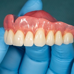 Full dentures in Marion