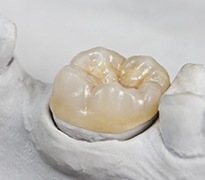 Model smile with dental crown restoration