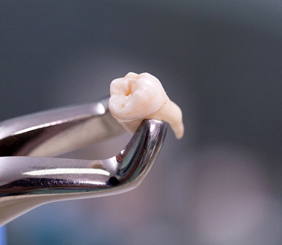 Closeup of dental tool holding tooth