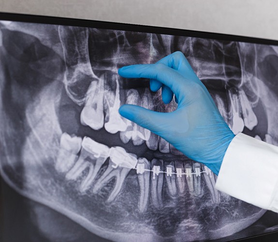 dentist looking at dental x-ray 