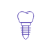 Animated dental implant supported dental crown highlighted