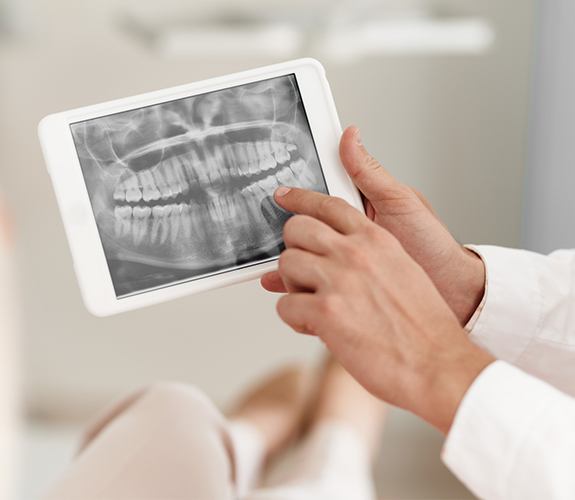 Digital x-rays on tablet computer