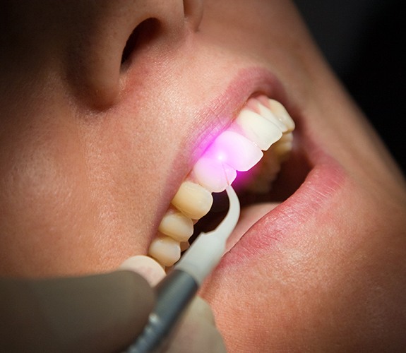 Patient receiving soft tissue laser dentistry