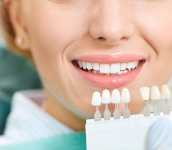 A dentist comparing tooth shades against a woman’s smile