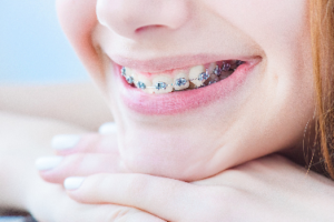 young girl with braces