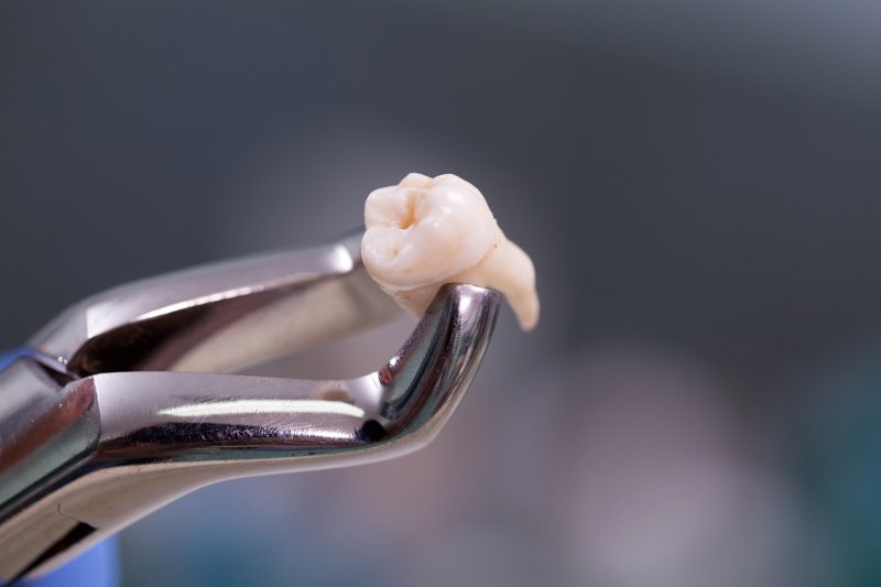 tooth being held in forceps
